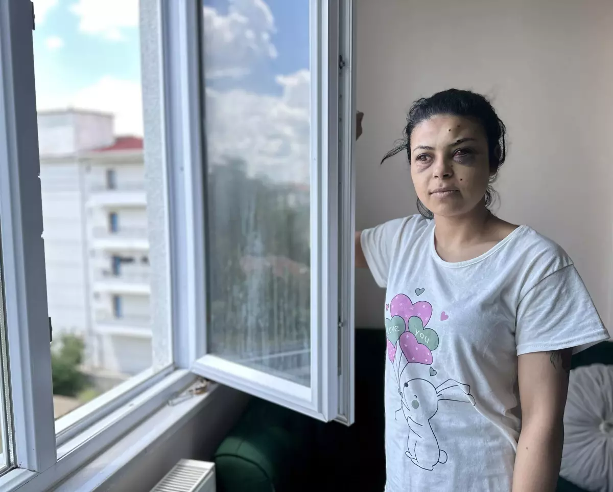 Pencereden düğünü seyrederken gözünden vuruldu: Hayatım bitti